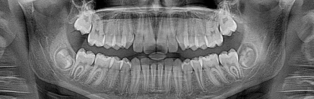 - Pure Gold Professionals in Dentistry - Redlands Dentist - Pure Gold Professionals in Dentistry - Redlands Dentist -