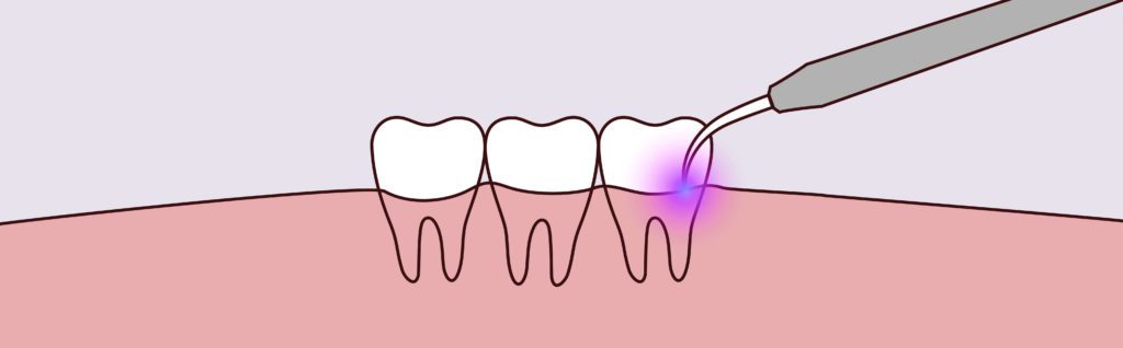 - Pure Gold Professionals in Dentistry - Redlands Dentist - Pure Gold Professionals in Dentistry - Redlands Dentist -