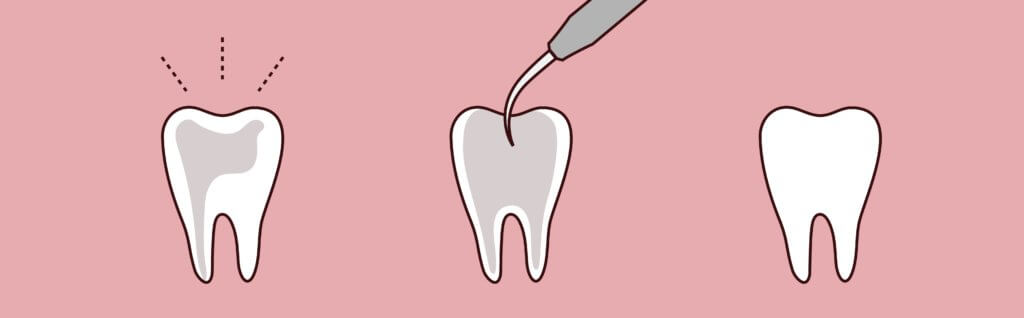Pure Gold Professionals in Dentistry - Redlands Dentist -