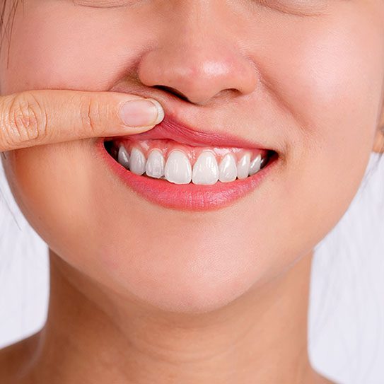 Pure Gold Professionals in Dentistry - Redlands Dentist -
