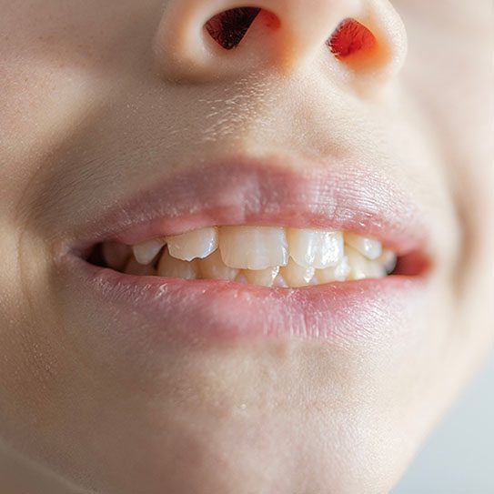 Pure Gold Professionals in Dentistry - Redlands Dentist -