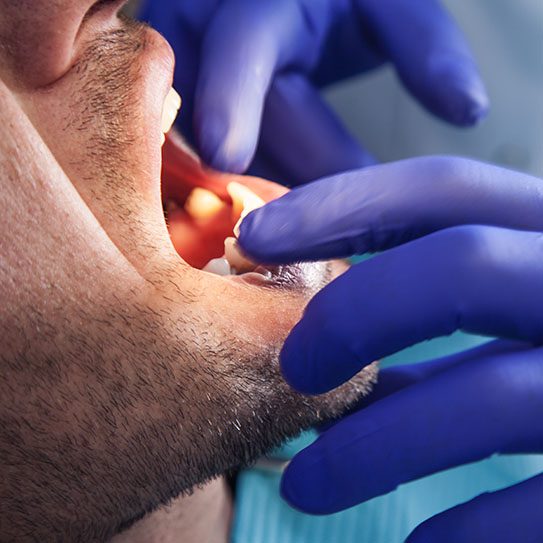 dentist cleanings