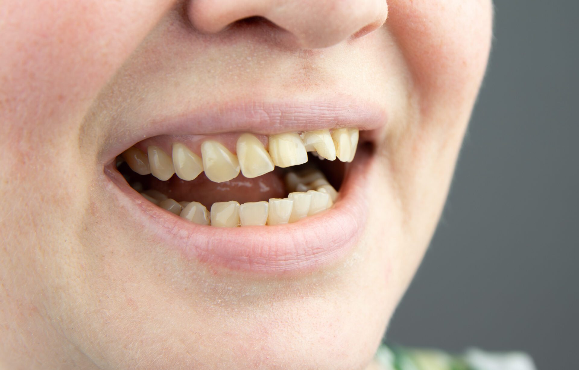 Pure Gold Professionals in Dentistry - Redlands Dentist -