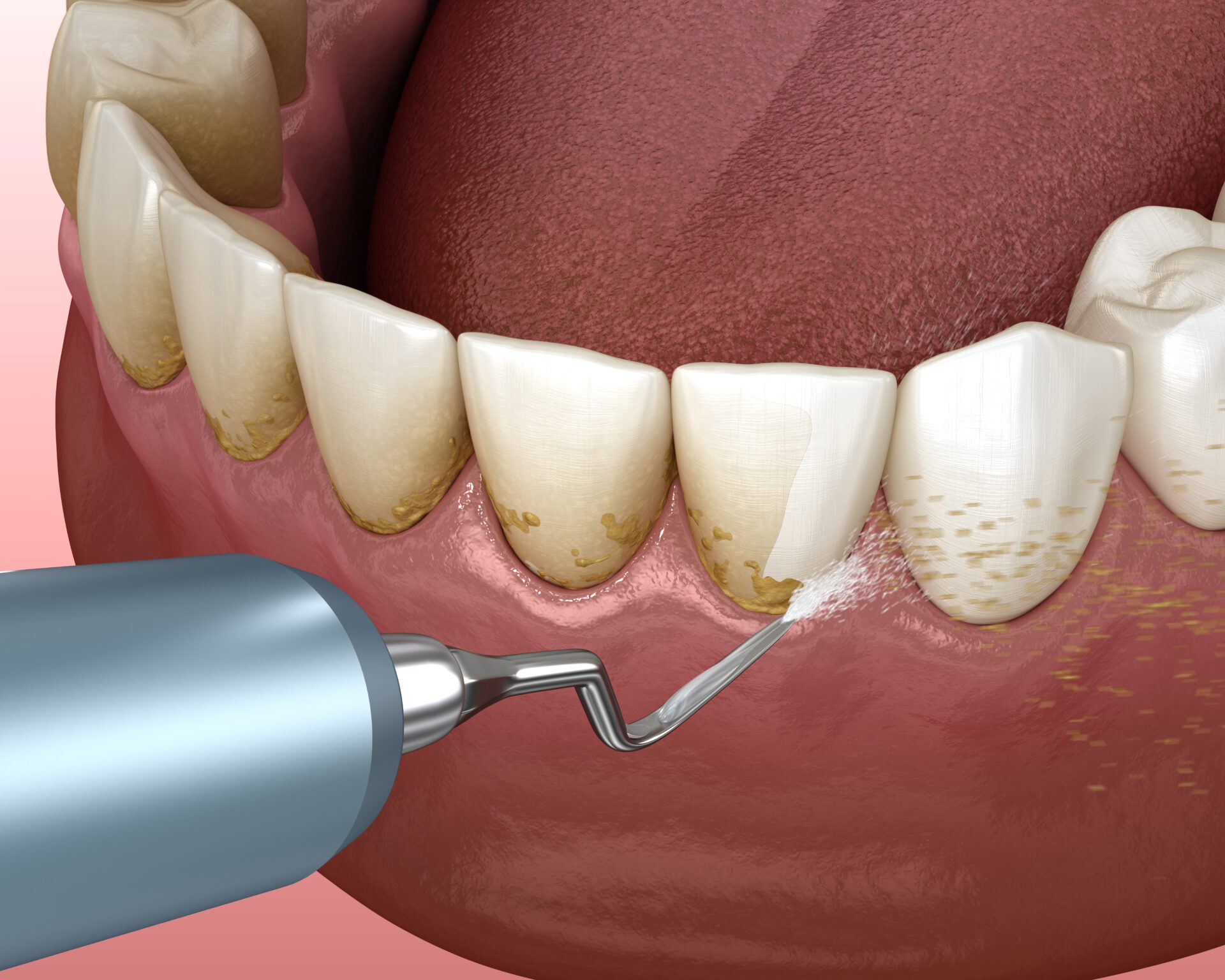 Pure Gold Professionals in Dentistry - Redlands Dentist -