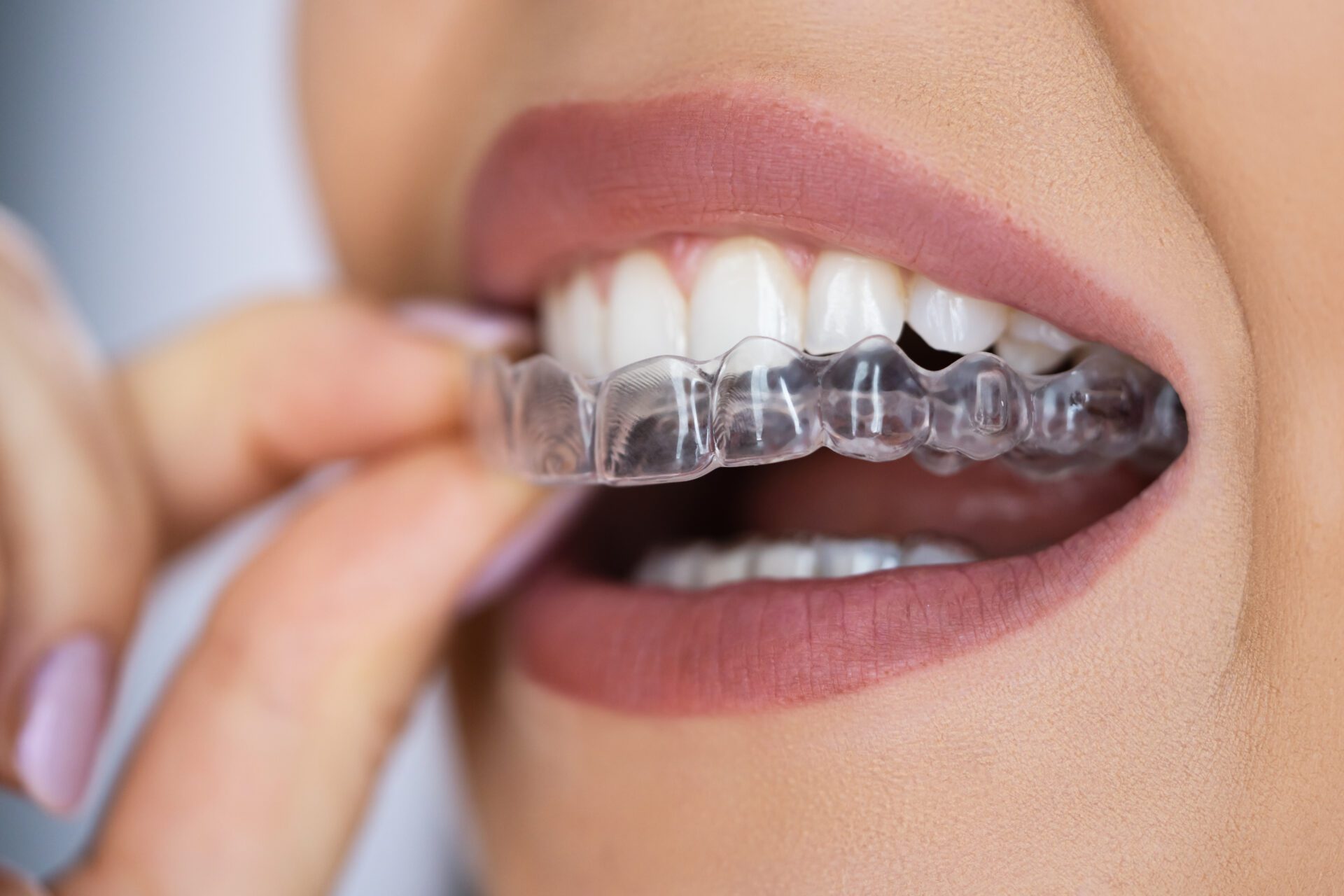 Pure Gold Professionals in Dentistry - Redlands Dentist -