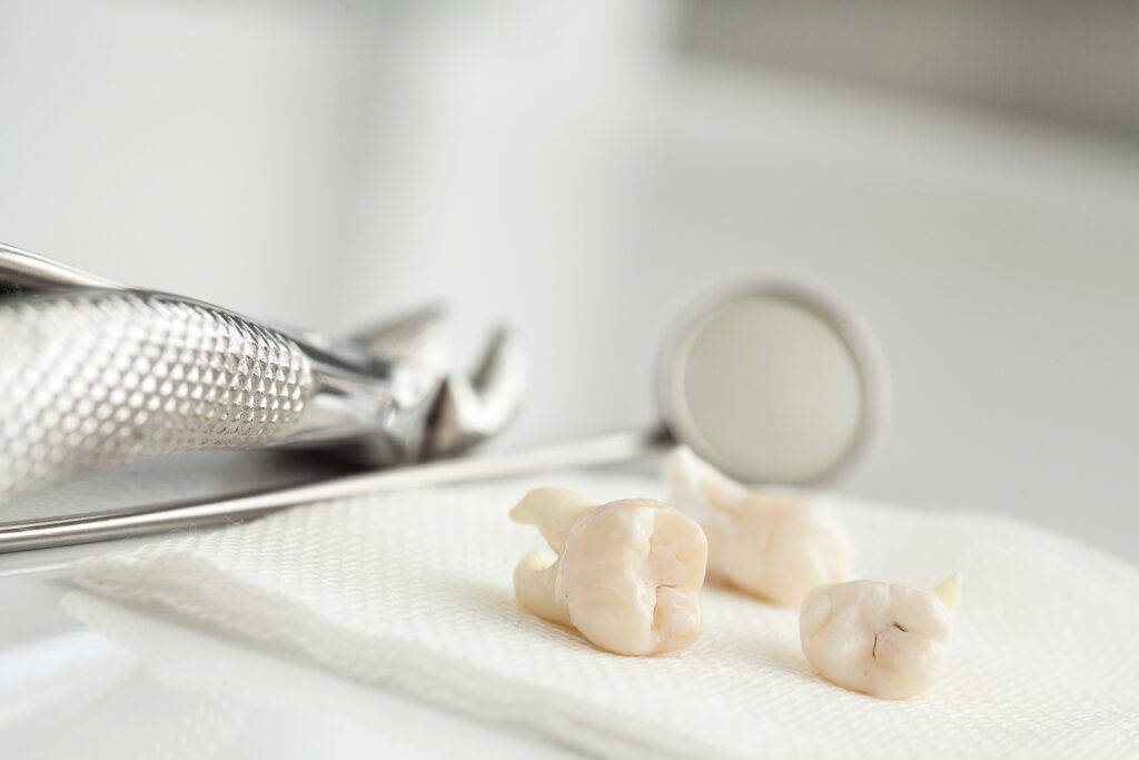 Pure Gold Professionals in Dentistry - Redlands Dentist -